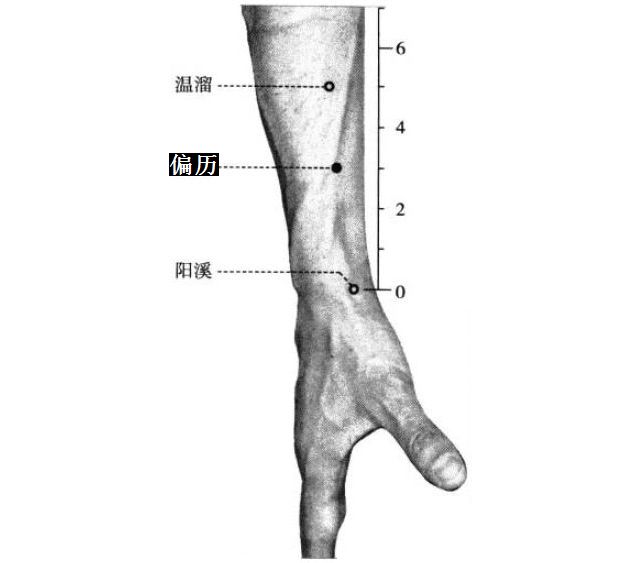 偏历的证治纲要与定位图解