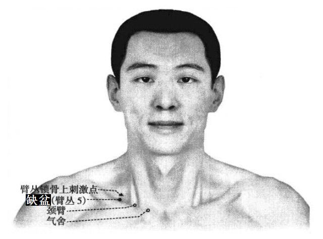 缺盆的证治纲要与定位图解