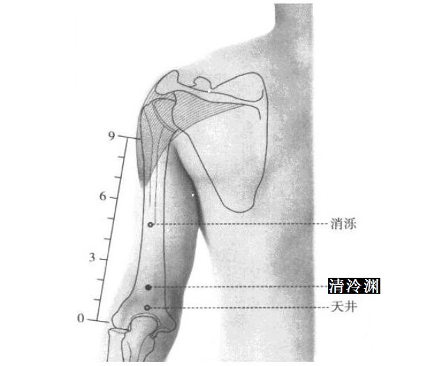 清泠渊的证治纲要与定位图解