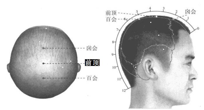 前顶的证治纲要与定位图解