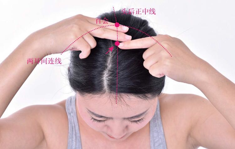 前顶的证治纲要与定位图解