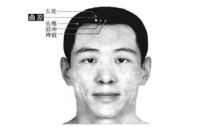 曲差的证治纲要与定位图解