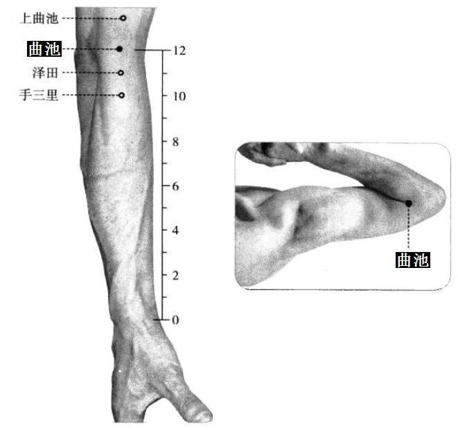特禀体质的日常调理