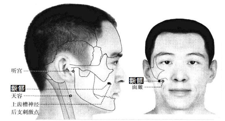 颧髎的证治纲要与定位图解