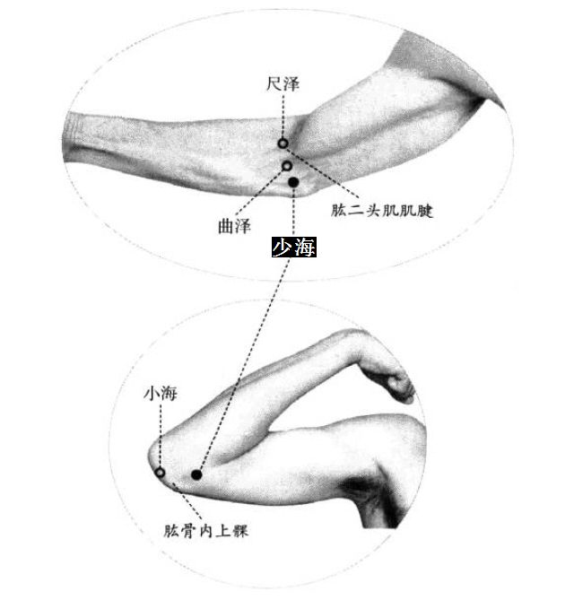 少海的证治纲要与定位图解