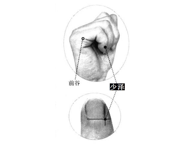 少泽的证治纲要与定位图解