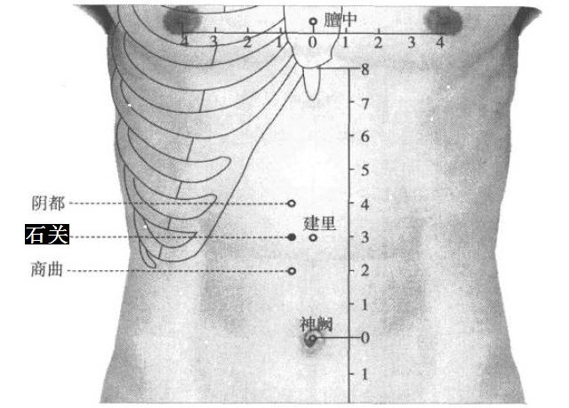 石关的证治纲要与定位图解