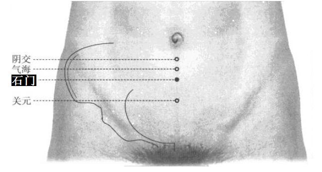石门的证治纲要与定位图解