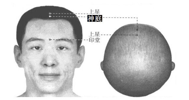神庭的证治纲要与定位图解