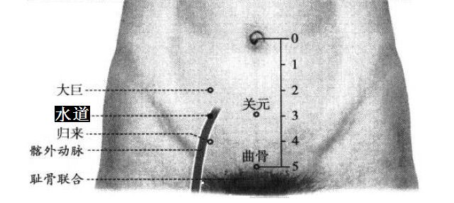 水道的证治纲要与定位图解