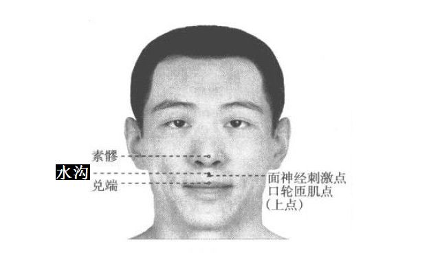 水沟的证治纲要与定位图解