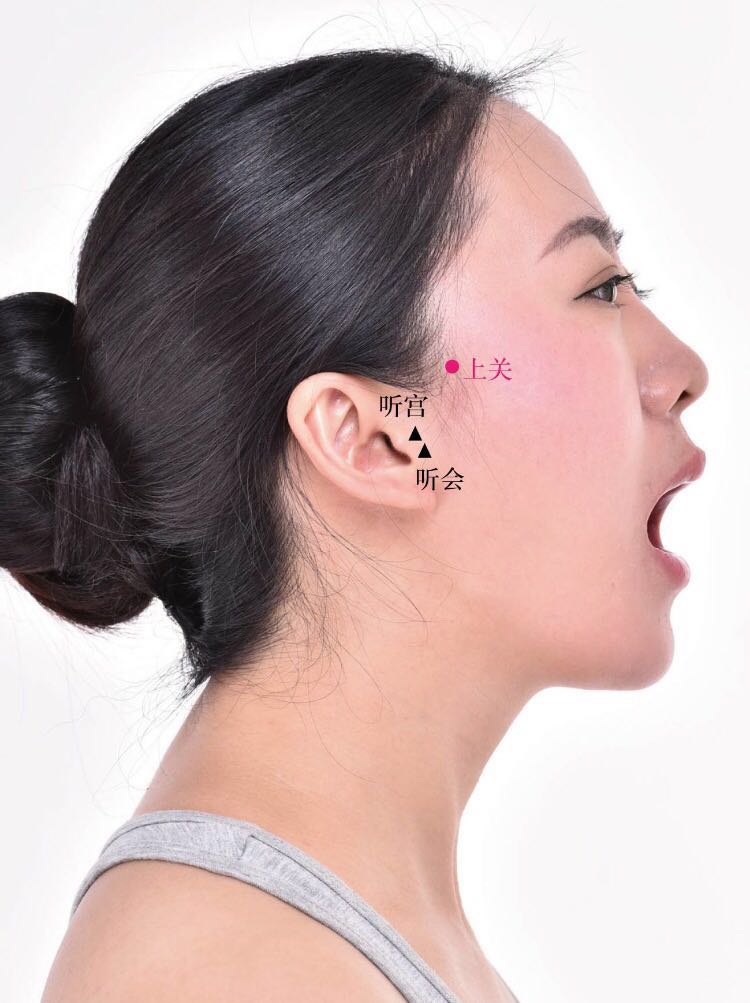上关的证治纲要与定位图解