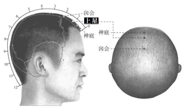 上星的证治纲要与定位图解