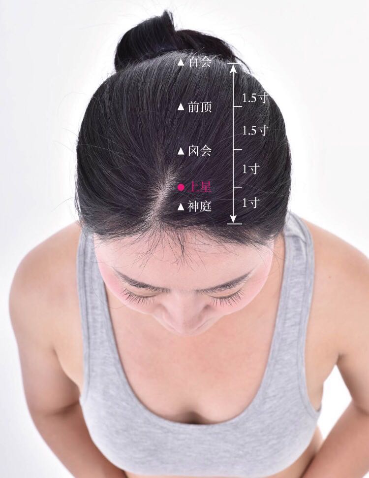 上星的证治纲要与定位图解