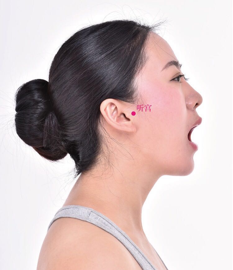 听宫的证治纲要与定位图解
