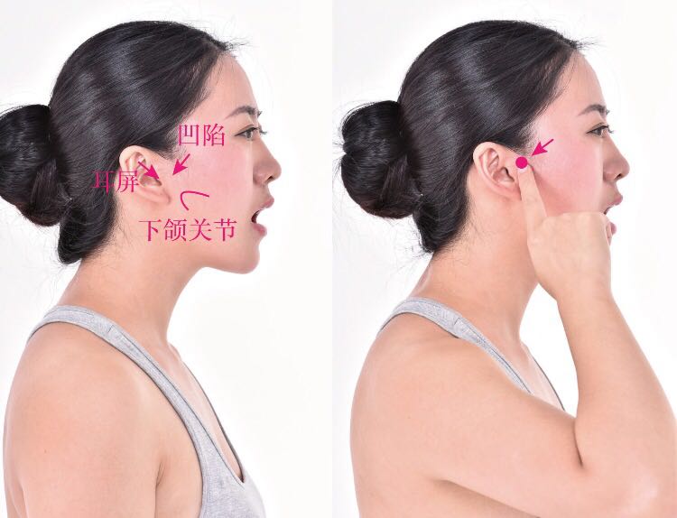 听宫的证治纲要与定位图解