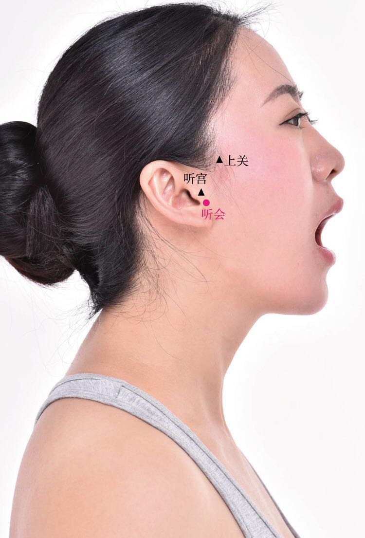 听会的证治纲要与定位图解
