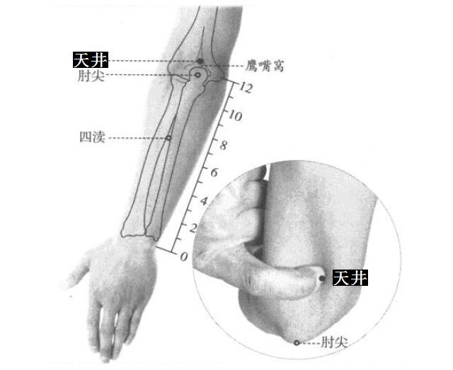 天井的证治纲要与定位图解