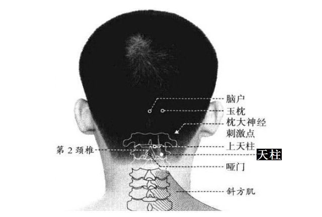 天柱的证治纲要与定位图解