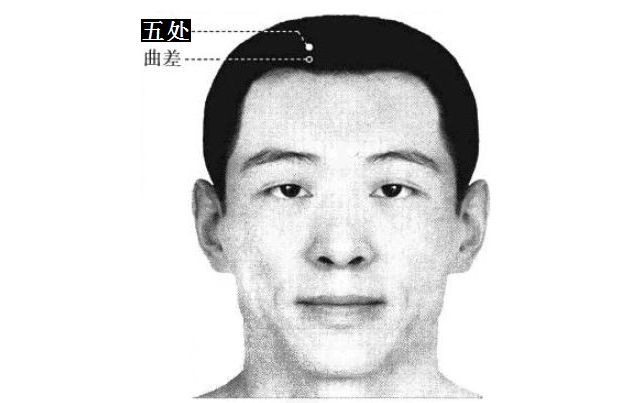 五处的证治纲要与定位图解