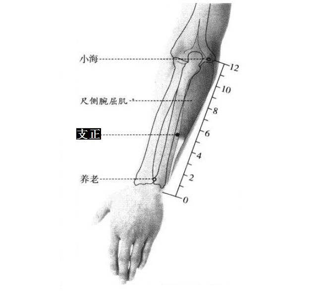 支正的证治纲要与定位图解
