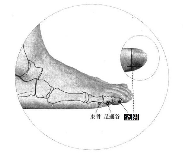 至阴的证治纲要与定位图解