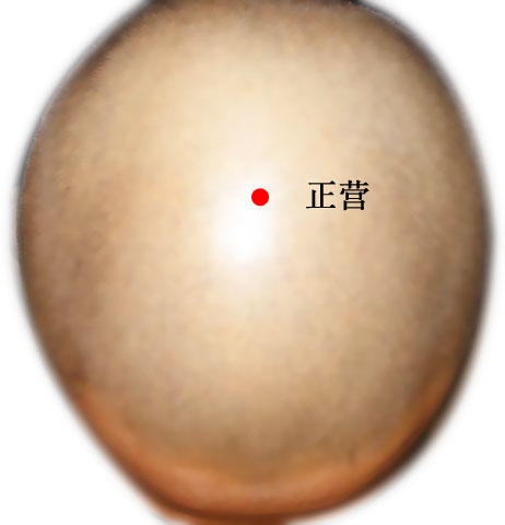 正营的证治纲要与定位图解