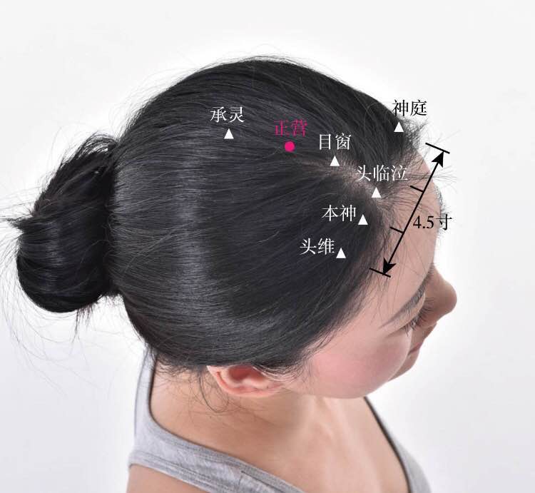 正营的证治纲要与定位图解