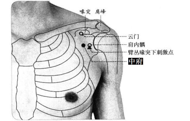 中府的证治纲要与定位图解
