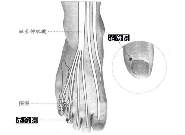 足窍阴的证治纲要与定位图解