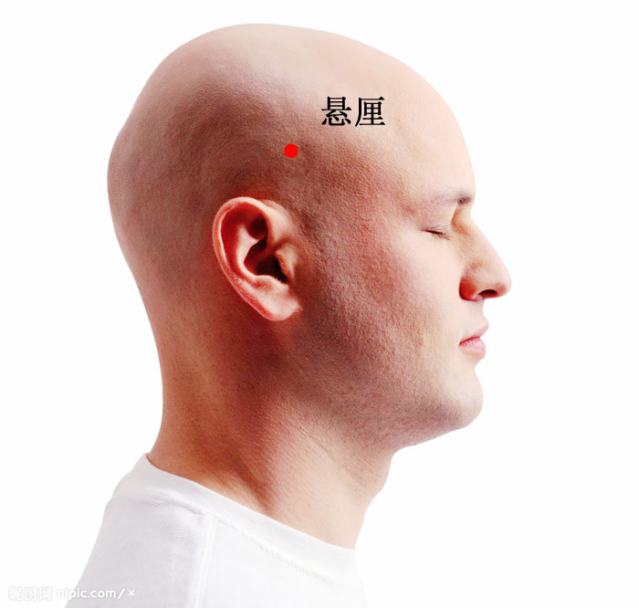 悬厘的证治纲要与定位图解