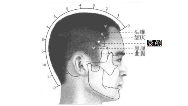 悬颅的证治纲要与定位图解