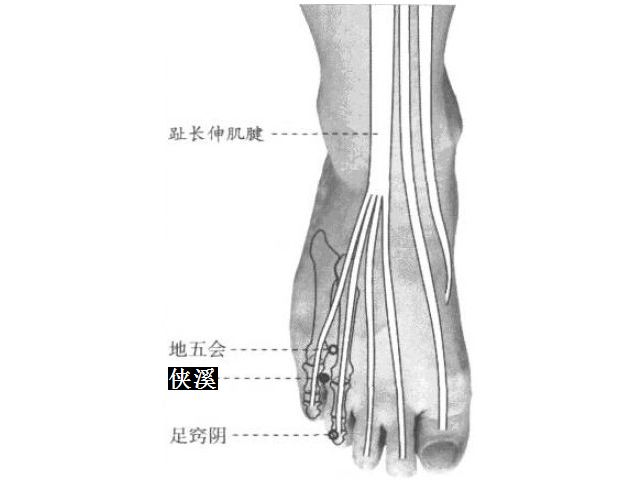 侠溪的证治纲要与定位图解