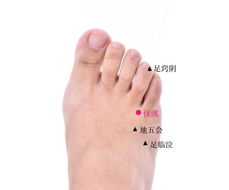 侠溪的证治纲要与定位图解