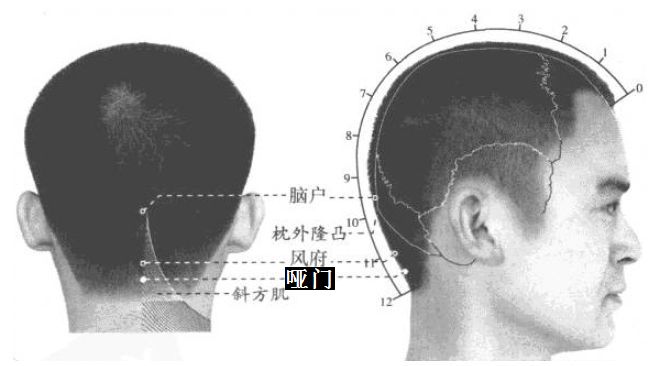 哑门的证治纲要与定位图解
