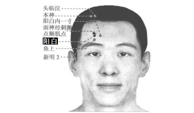 阳白的证治纲要与定位图解